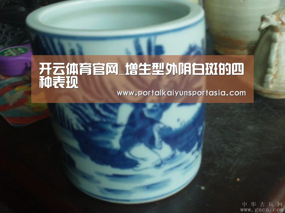 开云体育官网_增生型外阴白斑的四种表现(图1) KAIYUN体育